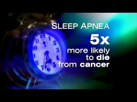 sleep-apnea