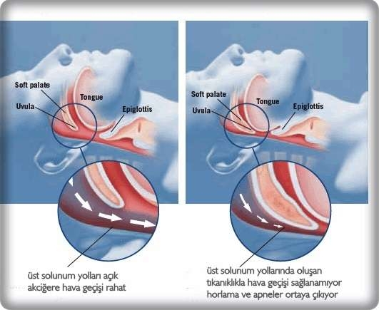 uyku-sirasinda-solunum