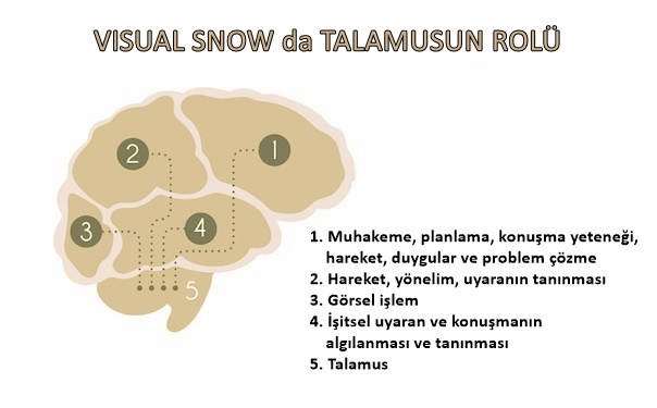 visual-snow-da-talamusun-rolü