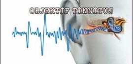 objektif-tinnitus-nedenleri