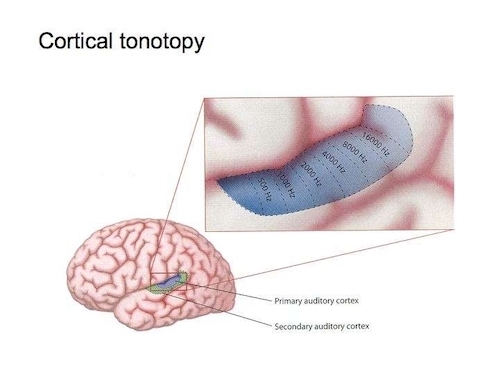 cortical-tonotopy