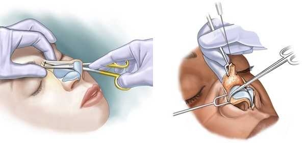 /burunun-sizdeki-anlami-ve-rolu-9145-0-0