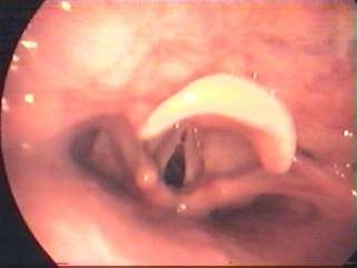 ses-bozukluklari-1-1