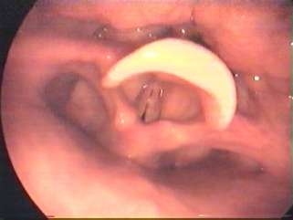 ses-bozukluklari-2-1