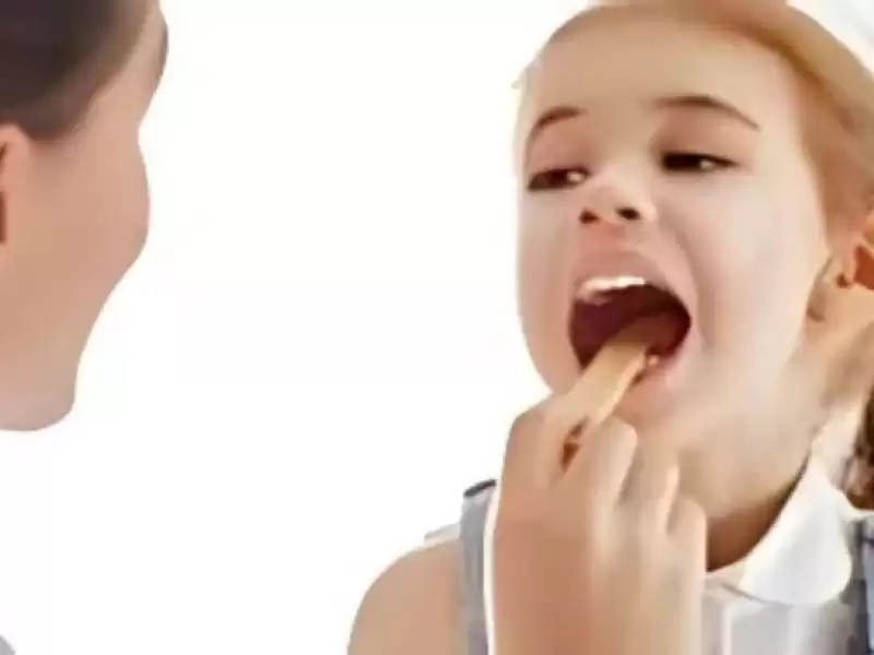 bademcik-ve-geniz-eti-ameliyati-sonrasi-yiyecek-listesi-ve-dikkat-edilmesi-gerekenler