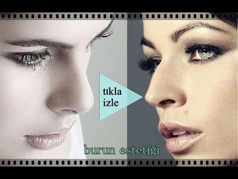 Rhinoplasty,burun estetiği,burun estetiğinin riskleri,burun estetik doktor seçimi,burun estetiğinde en iyi doktor,burun estetiğinde dikkat edilmesi gerekenler,burun estetiği zormudur,burun ameliyatı,burun etetiği nedir,rinoplasti,Nose (Human Sense
