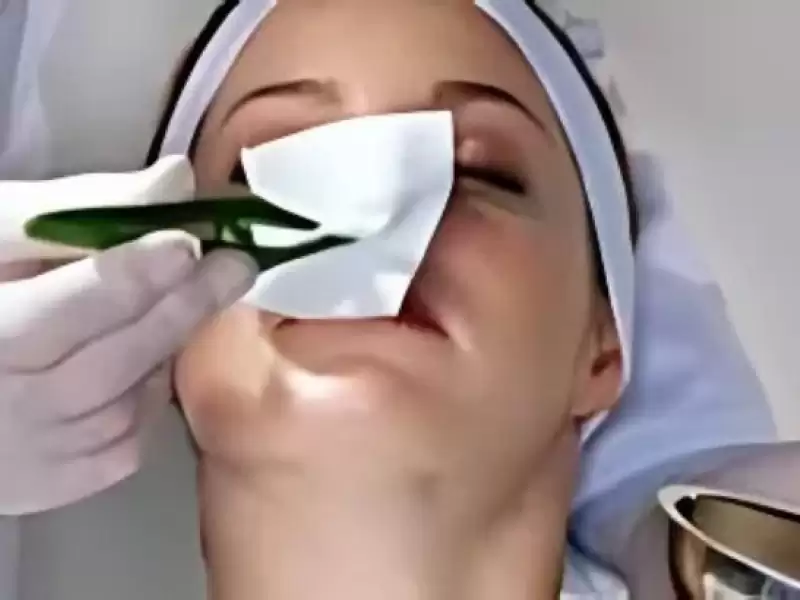 burun-estetik-ameliyati-sonrasi-hasta-rehberi