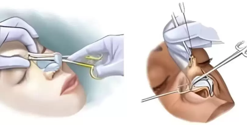 burunun-sizdeki-anlami-ve-rolu
