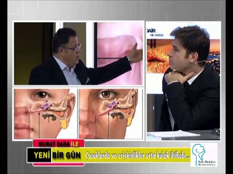 kulak iltihabı,seröz otit,östaki kanalı,tubal disfonksiyon,Eustachian Tube (Anatomical Structure),Otitis Media (Disease Or Medical Condition),Ear (Anatomical Structure)