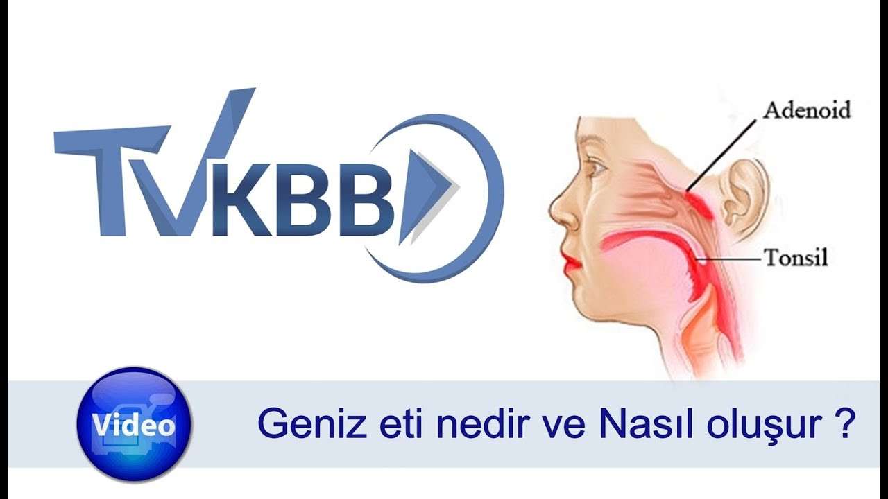 GENİZ ETİ,adenoid,geniz eti nedir,geniz eti nasıl oluşur,burun tıkanması,adenoid vejatasyon,geniz etinin oluşumu