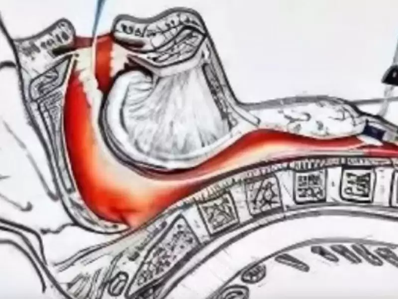 girtlak-kanseri-sonrasi-ses-protezi-nasil-uygulanir