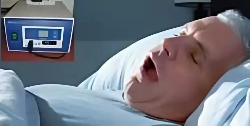 horlama-tedavisinde-radyofrekans-ve-procut-ile-cozum