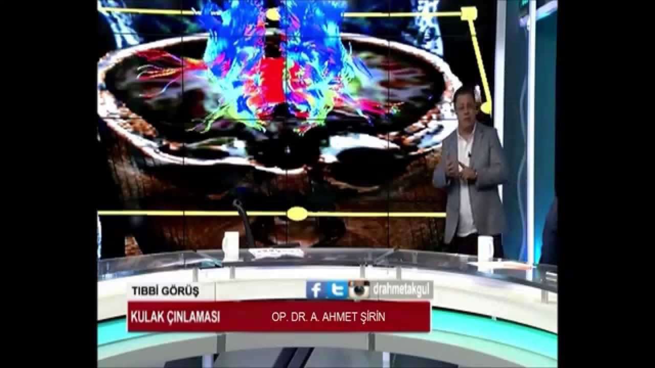 kulak çınlaması,kulak çınlaması teşhisi,Tinnitus (Symptom),kulakta uğuldama,kulak,çınlama,çınlama tetkikleri,Çınlama tanısı,çınlama tedavisi,kulak çınlaması tedavisi,kulakta uğultu,tinnitus,wideband typanogram,r-tms,vhit,vemp,fhit,ti