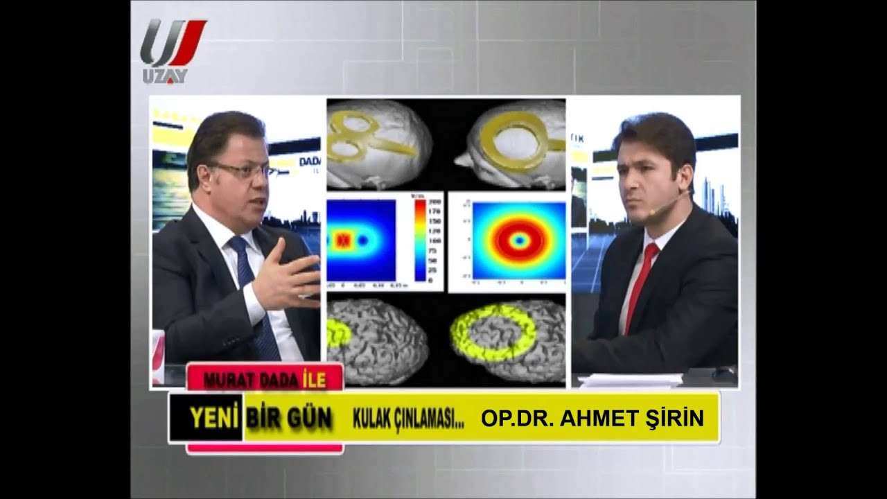 Transcranial Magnetic Stimulation (Medical Treatment),tms,kulak çınlaması,tinittus,tinnitus,transkranyal manyetik uyarı,tms cihazı,kulak,ali ahmet şirin,kulak burun boğaz,doktor,ahmet şirin,kulak uğultusu,kulakta ses,Health (Industry),KULAKTA UĞ