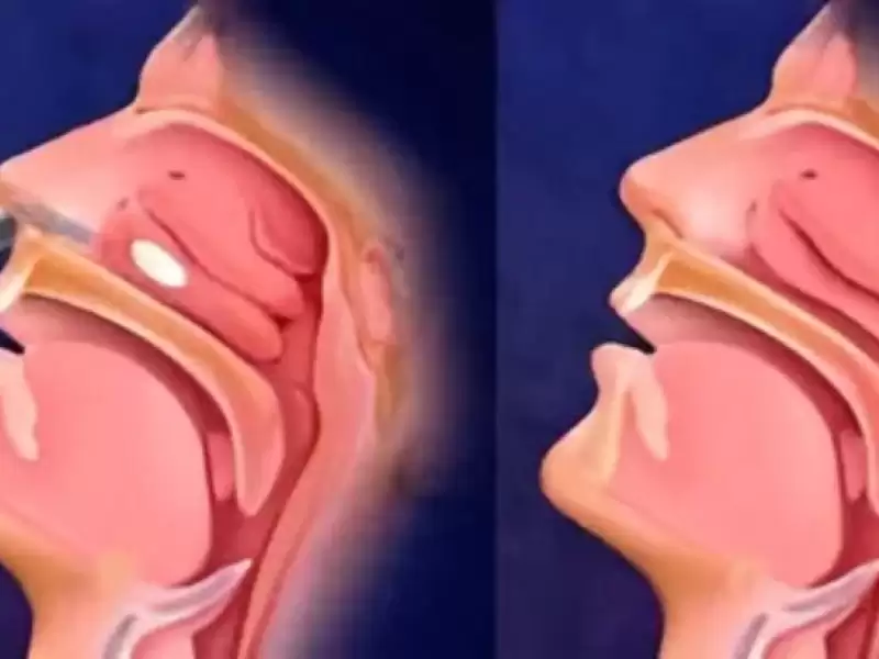 konka-kucultme-ameliyati