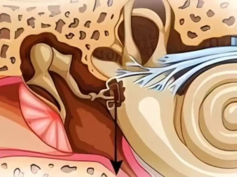 kulak-kireclenmesi-ve-tinnitus-iliskisi