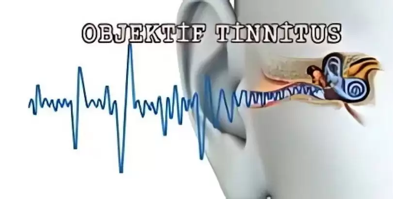 objektif-tinnitus-nedenleri