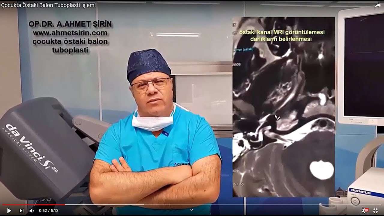 östakibalontuboplasti,östakikanalı,eustachiantubeballoondilation #eustachiantube,uçakbasınçsorunu,ear,istanbul,nişantaşı,abdiipekçicaddesi,aliahmetşirin