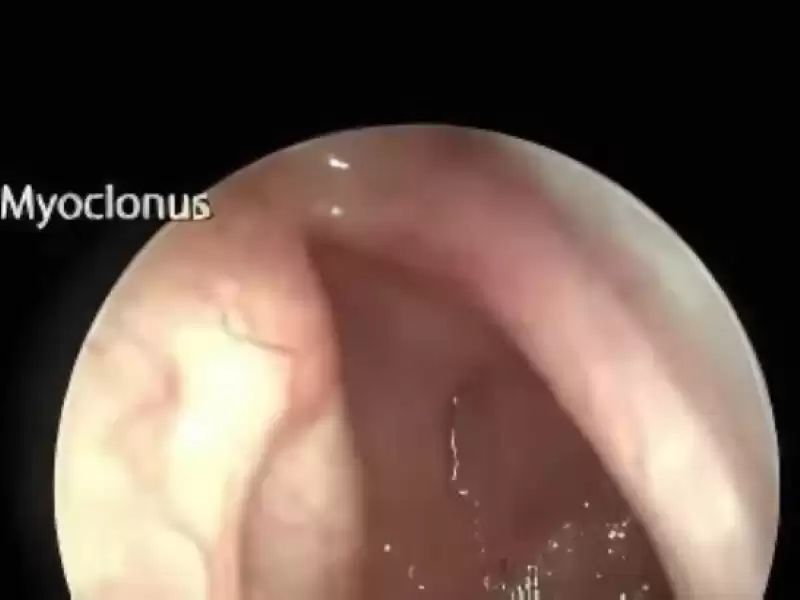 palatal-myoklonus-objektif-tinnitus-nedeni
