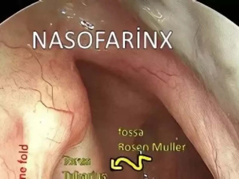 patulous-ostaki-tupu