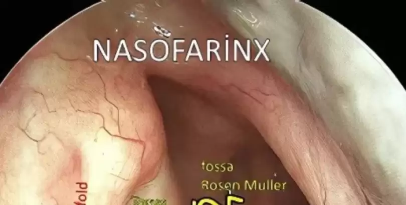 patulous-ostaki-tupu