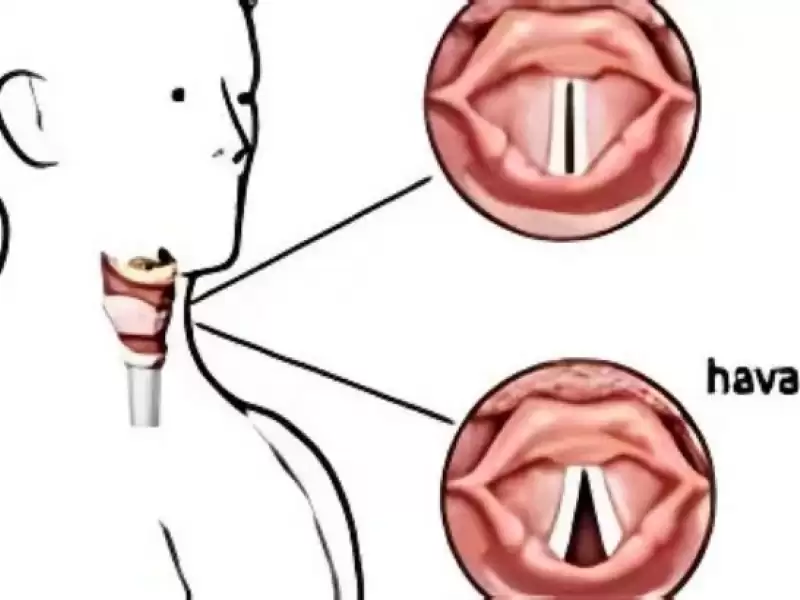 ses-teli-nodulu-ve-polipler