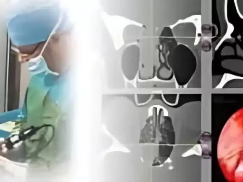 sinuzit-ameliyatlari