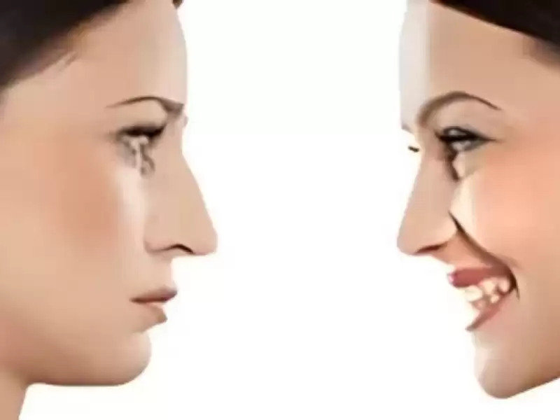 tekrar-nazal-rekonstruktif-cerrahi-veya-revizyon-rinoplasti