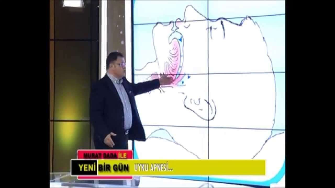 uyku apnesi,apne,tıkayıcı uyku hastalığı,osas,apne nedeni,uykuda tıkanma,neden apne olur,apnenin nedeni