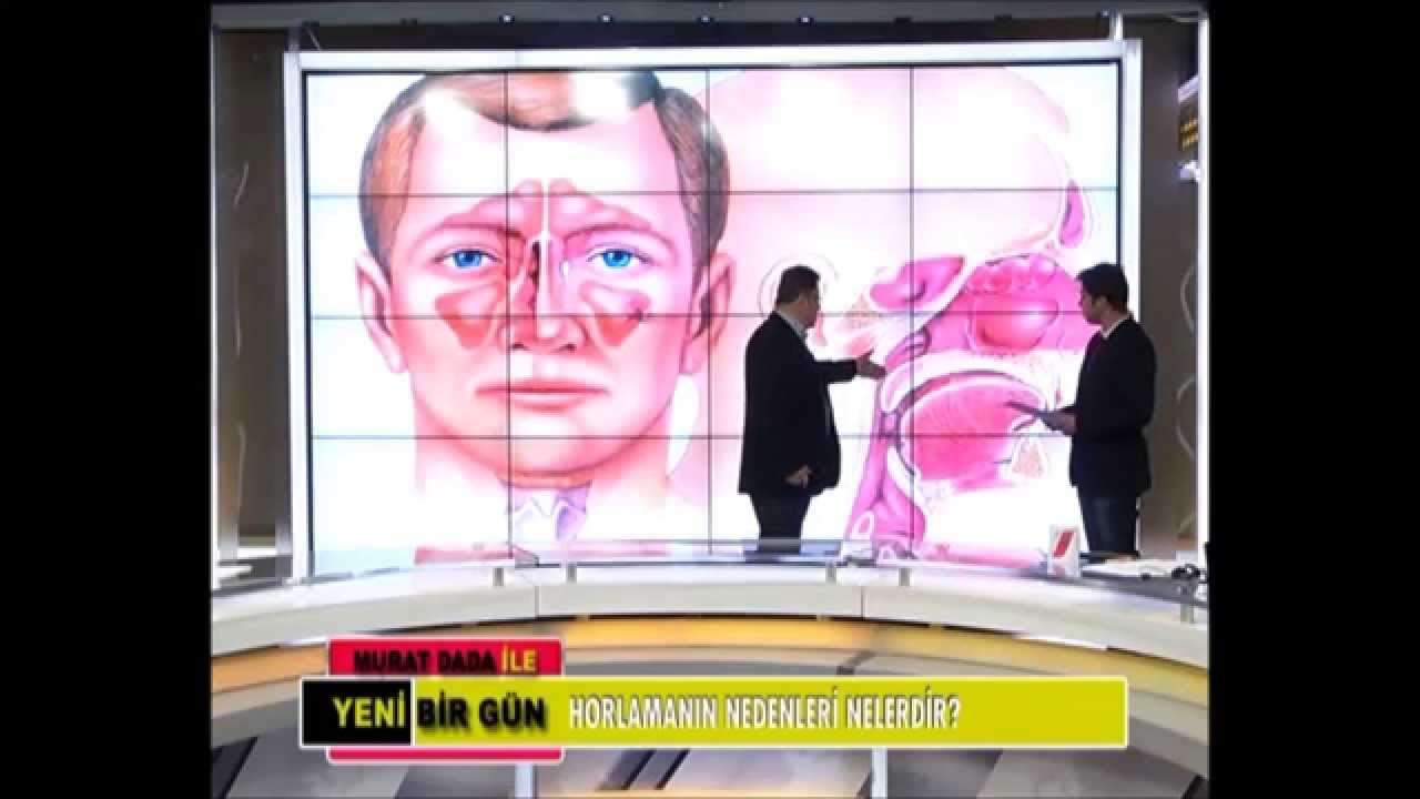 horlama,horlama tedavisi,horlama ameliyatı,horlama nasıl tedavi edilir