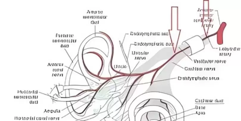 vestibuler-paroksismi