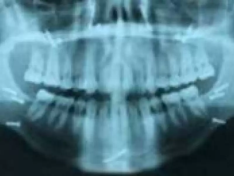 yuz-kiriklari-ve-ameliyatlari