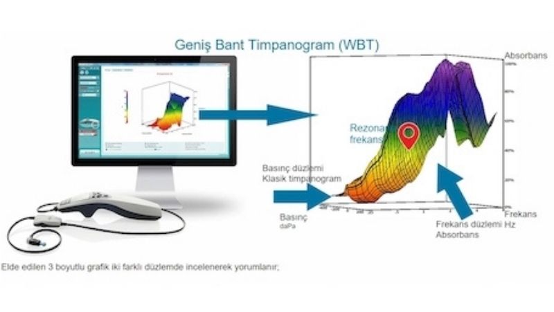 genis-bant-timpanogram