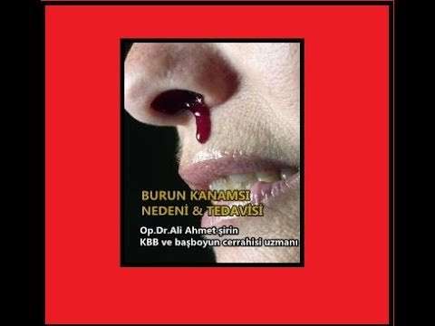 Çocukta burun kanaması,burun kanamsı,yetişkinde burun kanaması,burun kanamasında ne yapmalı,burun kanamsı nasıl durdurulur,burun kanaması tehlikelimidir,burun kanma sebebi,burun kansma nedeni,yaşlıda burun kanaması,burun kanaması tedavisi,bu