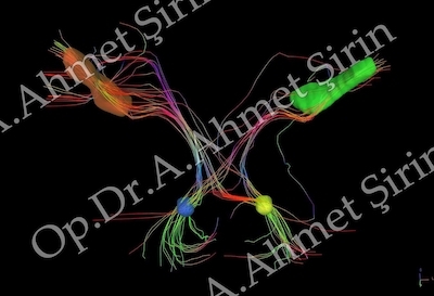 /tinnitusta-iyilesme-sureci