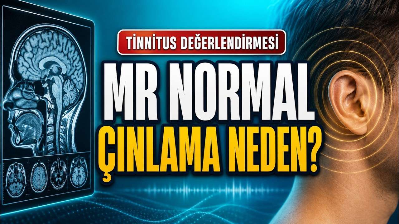 tinnitus,kulak çınlaması,tinnitus testleri,tinnitus tanısı,işitme testi,yüksek frekans odyometri,tinnitometri,akustik refleks,geniş bant timpanometri,Östaki fonksiyon testi,pulsatil tinnitus,tinnitus MR